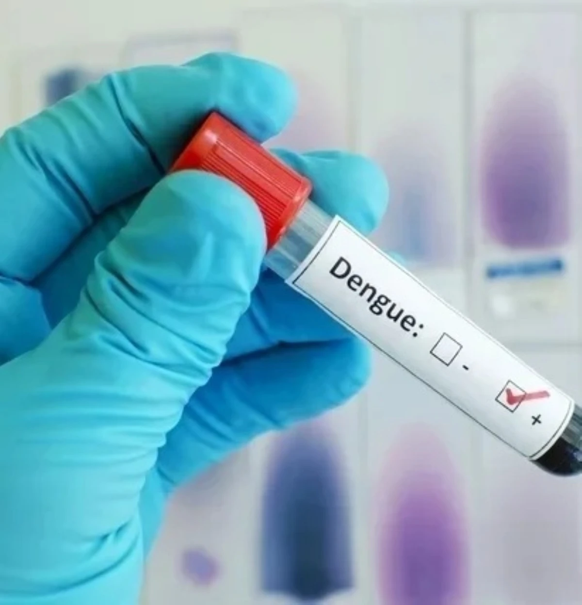 epidemie peste 1000 de cazuri